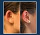 Slider image (10) Dr. Jose E. Telich - Plastic Surgeon